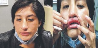 Agente denuncia a su pareja por violencia contra la mujer