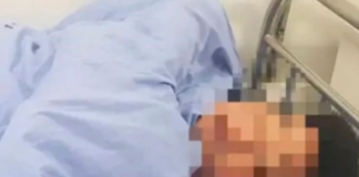 Mujer amputa el pene a su pareja tras supuestamente comprobar que abusaba de su hija