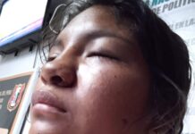 Mujer es atacada a golpes en el día de la madre por ir de visita donde su progenitora