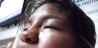 Mujer es atacada a golpes en el día de la madre por ir de visita donde su progenitora