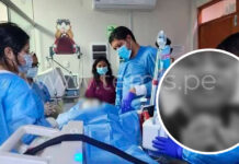 Piura: Fallece menor que cayó a balde de chicha hirviendo