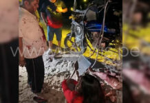 Piura: Menor pierde la pierna tras grave accidente en Yaparatera