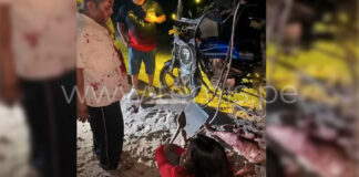 Piura: Menor pierde la pierna tras grave accidente en Yaparatera